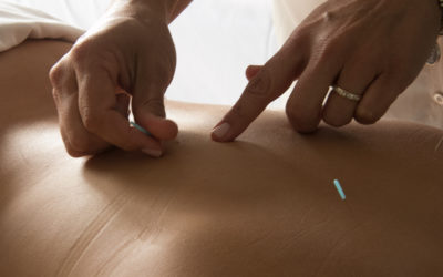 What Is Distance Acupuncture | Tanya Mei-Tai Coon, LAc