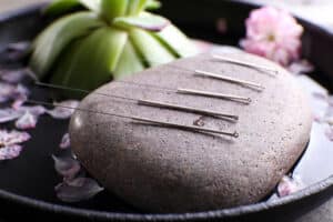 acupuncture needles in a spa setting resting on a stone